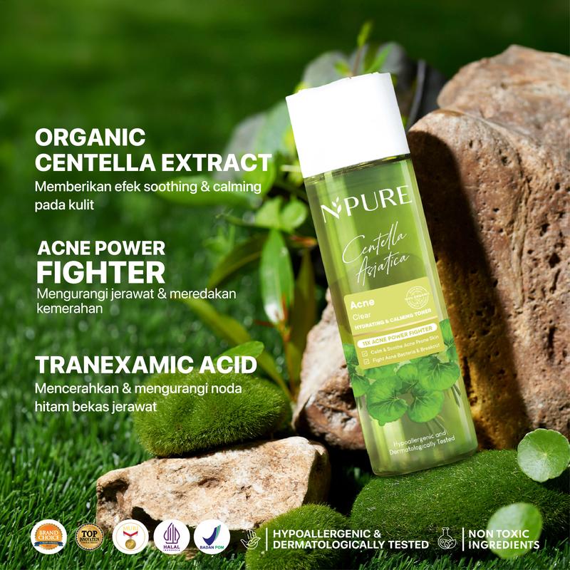 【Bundle Power Series】NPURE Hydrating Acne Toner 150ml + Power Powder / Acne Toner / Toner Kulit Jerawat Berminyak / Berjerawat Mencerahkan/Acne powder - 5